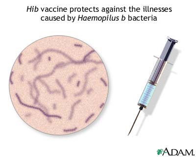 Hib immunization (vaccine)