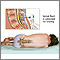Lumbar puncture (spinal tap)