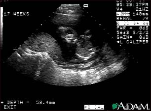 Ultrasound, normal fetus - face