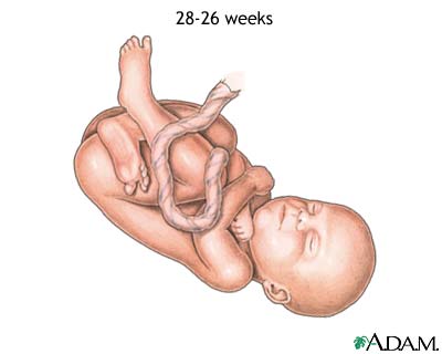 26 to 28-week fetus