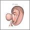 3.5 week fetus