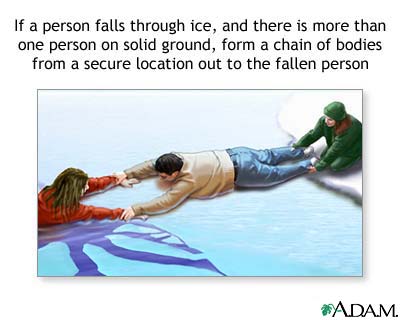 Drowning rescue on the ice, human chain