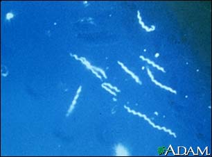 Lyme disease - Borrelia burgdorferi organism