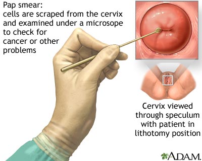The Pap smear