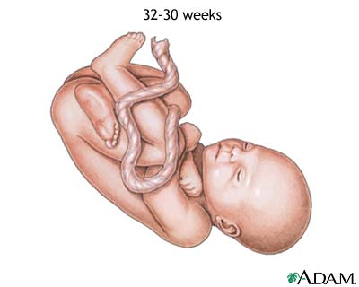 30 to 32 week fetus