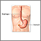 Gastrostomy tube placement - series