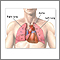 Heart-lung transplant - series
