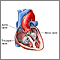 Heart valve surgery - series